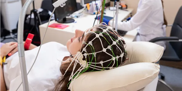 TMS Therapy